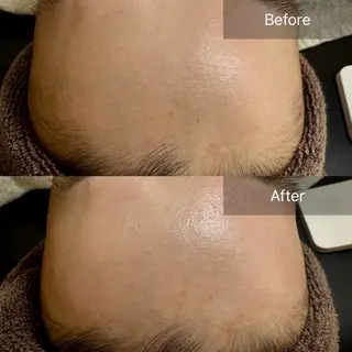 enine フェイスWAXのエステ・リラクイメージ