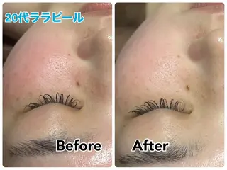 【毛穴・美白・美肌】 美・up 青葉台店のエステ・リラクイメージ