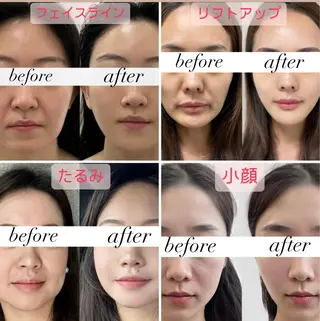 愛維美水光美肌専門店 メンズレディースokのエステ・リラクイメージ