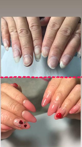 無加工でこの違い️
バレンタインネイル＆ハンドケア 