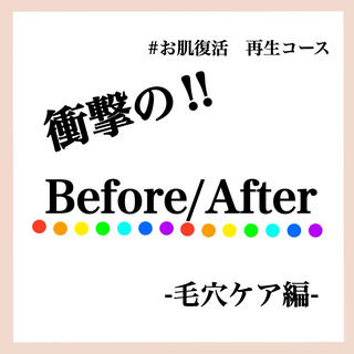 圧倒的結果のでる毛穴ケア 