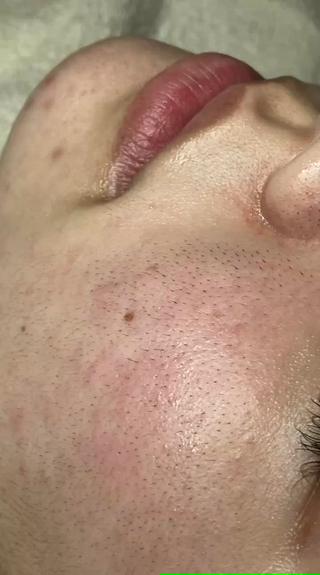 3ヶ月間2週間に一回通った結果です 