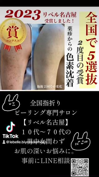 腕の色素沈着を剥離ハーブピーリングで改善