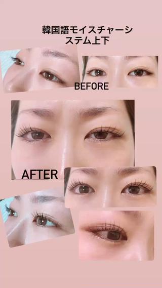 韓国モイスチャーシステムも凄いですが、ラッシュアディクト効果もヤバいです
日本人女性の平均約6.8㎜ですが、こちらのお客様は約倍の12㎜でした 