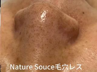 Nature Souce毛穴専門店のその他イメージ
