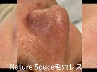 Nature Souce毛穴専門店のその他イメージ