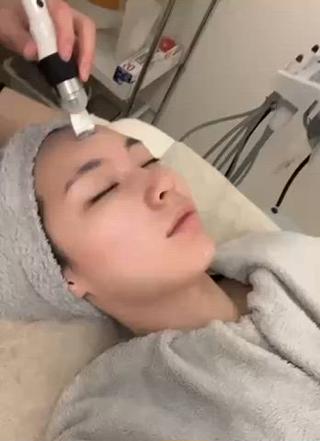 オプションメニュー【ディープクレンズ】、毛穴の目立ち、角栓除去、Tゾーンのザラつき解消 