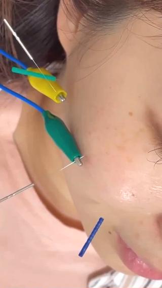 筋肉に電気が流れるとピクピクと動きます 