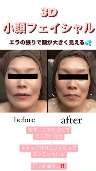 骨から若返る美骨＆ 小顔サロンクラルテのエステ・リラクイメージ