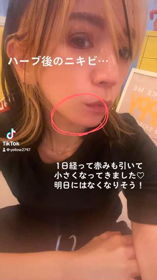 yellow💛【 脱毛&フェイシャル】のエステ・リラクイメージ