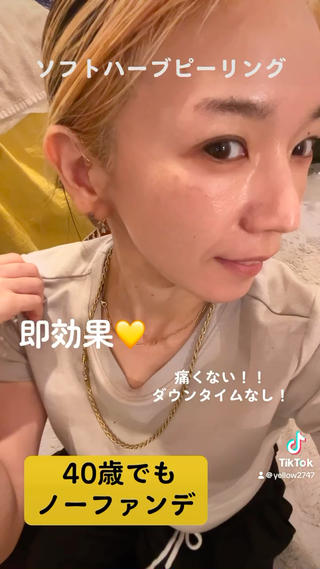 yellow💛【 脱毛&フェイシャル】のエステ・リラクイメージ