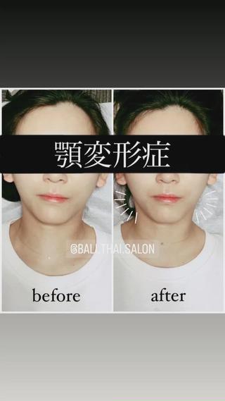 🌈歪み改善🌈 バリンタイ すぎうらのエステ・リラクイメージ