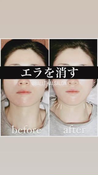 🌈歪み改善🌈 バリンタイ すぎうらのエステ・リラクイメージ