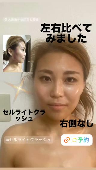 セルライトクラッシュ ＆腸もみ＋骨盤矯正のその他イメージ