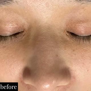 
#井高野
 #自宅サロン
 #エステ 
 #肌質改善 
＃艶肌
＃ハリ感
＃シワ改善
 #完全予約制
 #ハイドラ
 #毛穴洗浄
 #毛穴レス
 #ハイドラフェイシャル
 #ハイドラフェイシャルエステ
＃ゾンビマスク
 #パック
 #上新庄
 #IZM
 #ラッシュアディクト
 #リップアディクト
 #美容
 #こだわり
 #スキンケア
 #毛穴特化
 #オールハンドエステ
 #美容マニア
 #長女
 #姉妹
 #美容姉妹
 #メイク 