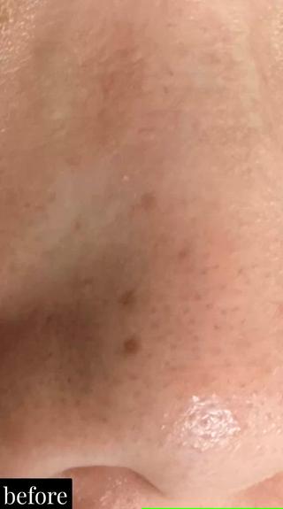 

#井高野
 #自宅サロン
 #エステ 
 #肌質改善 
＃艶肌
＃ハリ感
＃シワ改善
 #完全予約制
 #ハイドラ
 #毛穴洗浄
 #毛穴レス
 #ハイドラフェイシャル
 #ハイドラフェイシャルエステ
＃ゾンビマスク
 #パック
 #上新庄
 #IZM
 #ラッシュアディクト
 #リップアディクト
 #美容
 #こだわり
 #スキンケア
 #毛穴特化
 #オールハンドエステ
 #美容マニア
 #長女
 #姉妹
 #美容姉妹
 #メイク 