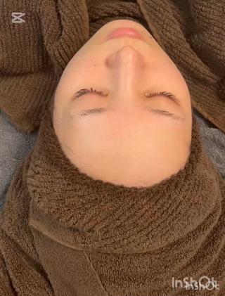 ■剥離しないピーリング
1回で効果が実感できる今までにないピーリング
1度受けたらやみつきに