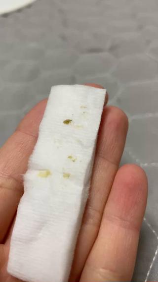 その場で取れた角栓、汚れが見れます！ 