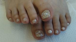 埋め込みネイル
 