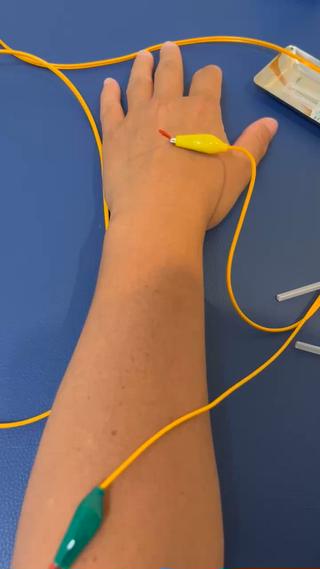 鍼に電気を流すとこのように筋肉へ刺激が加わり、筋収縮が起こります!
中指が動いているのは見えますか?