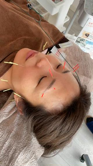 水島 秀輝（美容鍼灸師）のその他イメージ