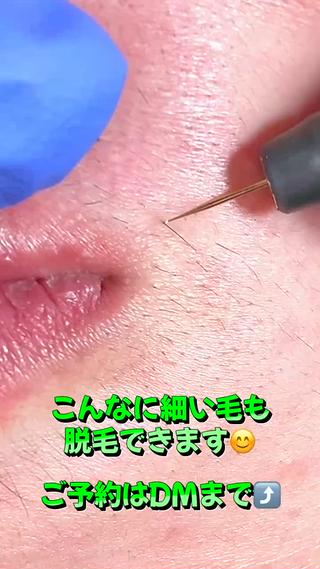 メンズ 【一本ずつ脱毛】 ReMove 柏のエステ・リラクイメージ