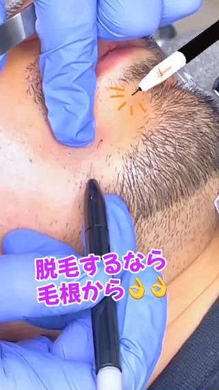 メンズ 【一本ずつ脱毛】 ReMove 柏のエステ・リラクイメージ