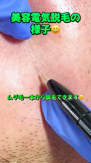 メンズ 【一本ずつ脱毛】 ReMove 柏のエステ・リラクイメージ