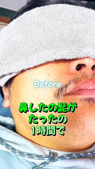 メンズ 【一本ずつ脱毛】 ReMove 柏のエステ・リラクイメージ