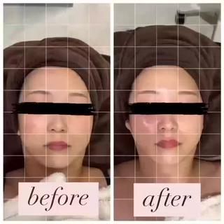 Oberio オベリオのエステ・リラクイメージ