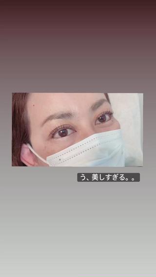 目ヂカラに押しつぶされそうー
眩しくて見れない

自まつ毛が長い方は大きめのカールを
チョイス
テンションをかけて巻きますので
根本からの立ち上げも効いてます

美容液成分配合のセッティング剤ですので
ラッシュリフト（まつげパーマ）をしながら
まつげケアができちゃいます

ラッシュリフト（まつげパーマ）
通常価格4000円 