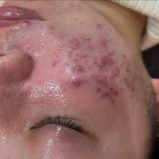 leolo武蔵浦和 肌質改善＆脱毛のエステ・リラクイメージ