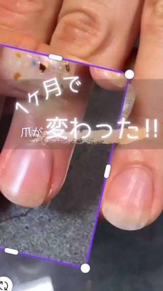 深爪緩和・自爪育成。ちび爪・噛み爪・深爪で悩みの方大歓迎。ワンカラーのみ。仕上げは自爪風のマット仕上げも可能です。 