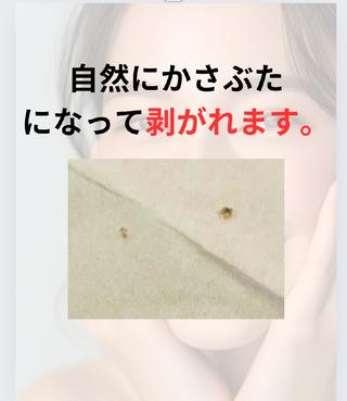 ☺ハーブピール💕 ソフィアカロン💖のエステ・リラクイメージ