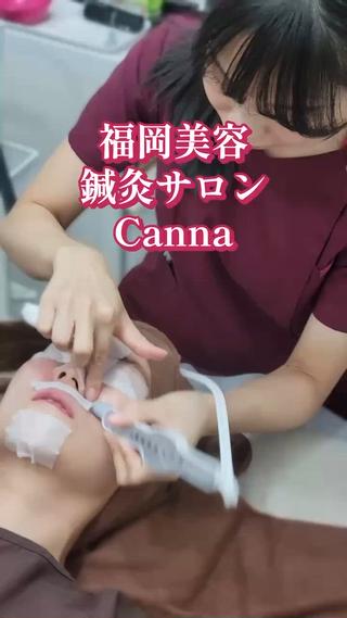 【美容鍼・小顔鍼】 鍼灸師　吉田洋美のエステ・リラクイメージ