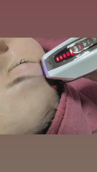 たるみ・小顔・老け顔
気になる方はお試し下さい 