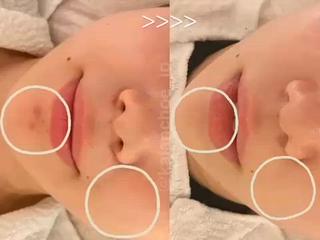 謹賀新年
KALANCHOEでは2025年新しくモニター様を募集しております

《本気でお肌変えたい方！肌質改善したい方！》

６回まで同条件で受けていただくことが可能で写真にはお目元にはモザイクが付きます。
男性の方もご利用いただけます！！

ご予約お待ちしております
=================
KALANCHOE
中目黒駅3分

【営業時間】 
月～金/09:30～21:00
土日祝/11:00～20:00
=================
どんなお肌悩みもご相談くださいませ
・ニキビケア/跡/凸凹改善
・乾燥/ゴワつき/ザラつき
・毛穴悩み
その他 