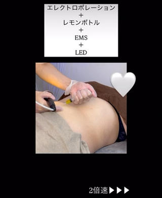 レモンボトルボディ 