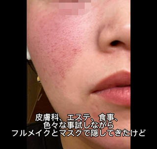Raviy 【痩身専門・肌管理】のエステ・リラクイメージ