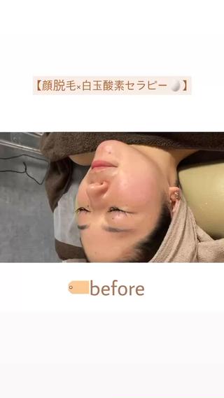【韓国肌管理・脱毛】 クレセントのその他イメージ