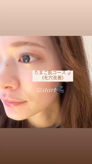 【韓国肌管理・脱毛】 クレセントのその他イメージ