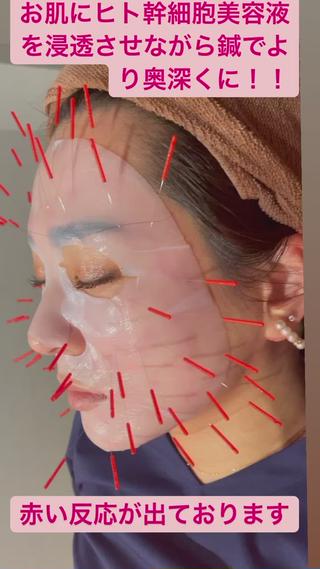 美容鍼灸サロン mahoroba院長のエステ・リラクイメージ