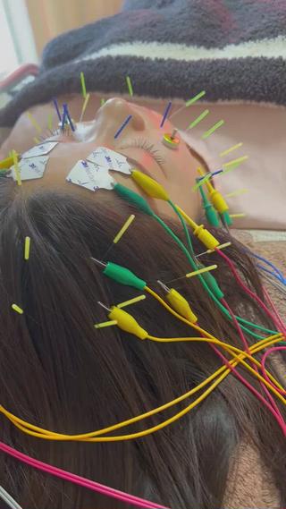 表参道鍼灸サロンmahorobaです。
表参道より徒歩２分になります。

美容鍼＋首肩こり治療
寒くて身体がガチガチなこの季節にお勧めです。
首肩のこりは、お顔のたるみにも影響します。
首肩ほぐしてお顔もリフトアップ

#表参道美容鍼
#鍼灸サロンmahoroba
#首肩こり
#小顔表参道
#垂水改善
#むくみ改善
#自律神経表参道 