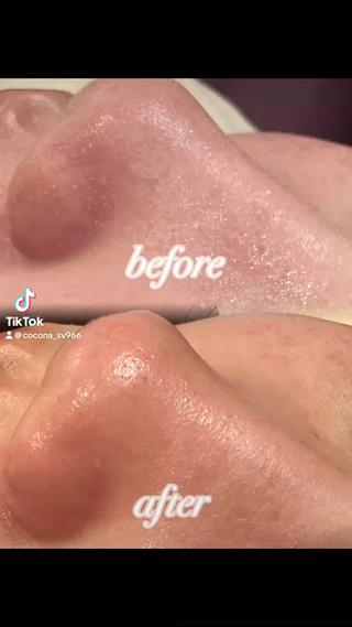 シェービング
beforeafter 