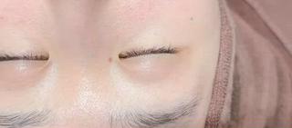 【アイリッドアップパーマ】の人気オプションインテンスカラートリートメント＆アイラッシュブラックフィルムでまつ毛がより長く濃くハリコシアップ 