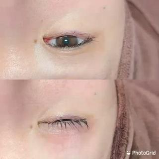 アイリッドアップパーマで瞼が上がり、まつ毛も上向に 