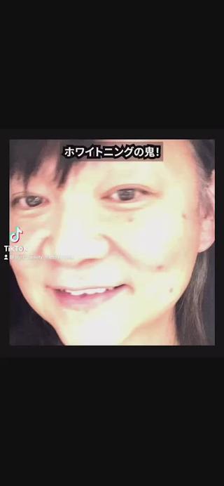 声優でナレーターさんの木村匡也様が動画を作ってくださいました~やはりプロのかたのナレーションは違います!元々38番だった歯が今では10番に笑顔も素敵です