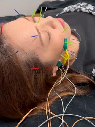 小顔矯正・美容鍼 FLOW鍼灸整体院のエステ・リラクイメージ