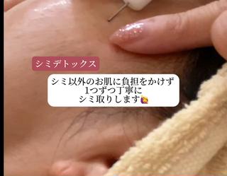 Ailes トータルビューティーのエステ・リラクイメージ