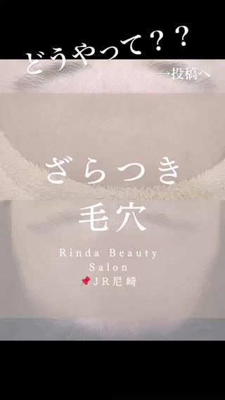 肌質改善はホットペッパー、もくはメッセージよりご予約お受けしております。 